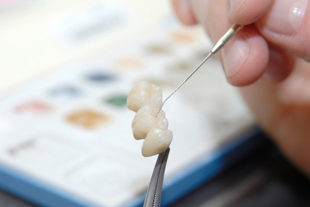 Mit dem Abdruck des Gebisses, dass der Zahnarzt dem Zahntechnikermeister zusendet beginnt der Arbeitsprozess.